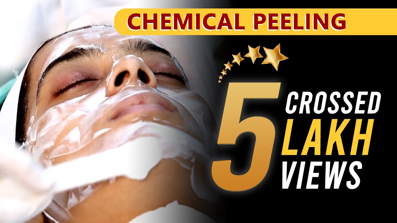 Chemical Peeling (केमिकल पीलिंग): Before & After| Full Procedure |  Sakhiya Skin Clinic