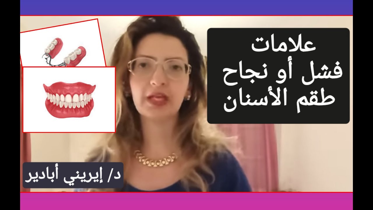 علامات فشل أو نجاح طقم الأسنان   #الأسنان #denture د/ إيريني أبادير