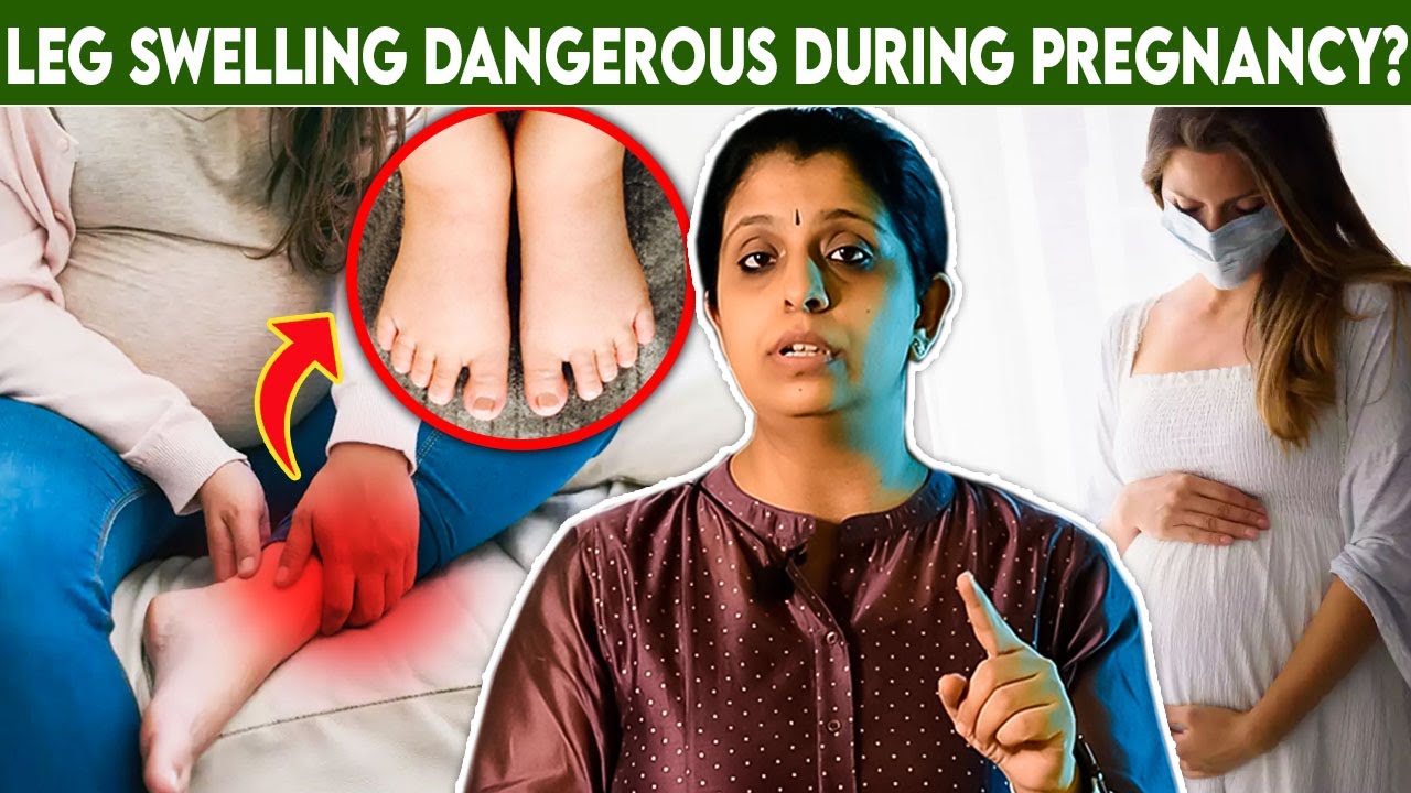 Pregnant Ladies-கு கால் வீங்க காரணம் என்ன? |Dr.Deepthi Jammi | Pregnancy Tips