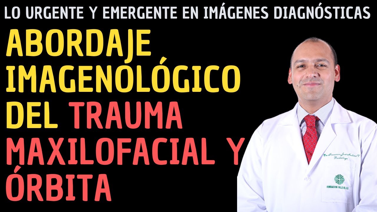 Abordaje imagenológico del trauma maxilofacial y órbita