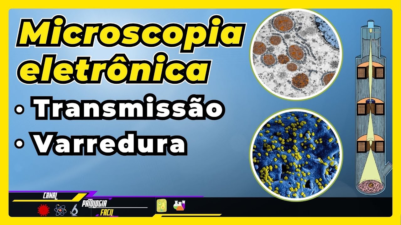 Microscopia Eletrônica: de Transmissão (MET) e de Varredura (MEV) | Biologia Celular e Citologia |