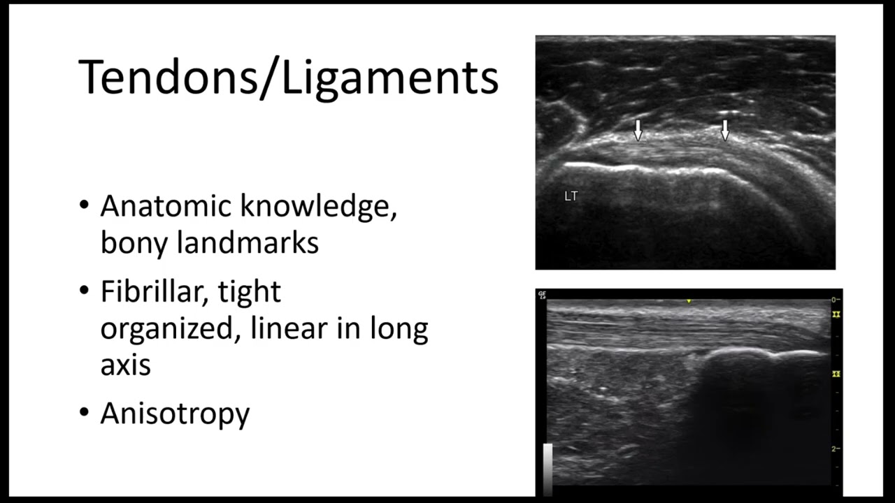 Upper Extremity POCUS Basic Anatomy and Technique