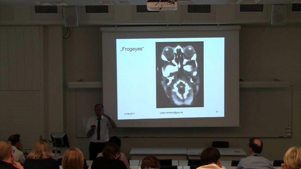 Osteopenia Of The Preterm Infant And Supplementation With Calcium, Phosphor - Walter Mihatsch