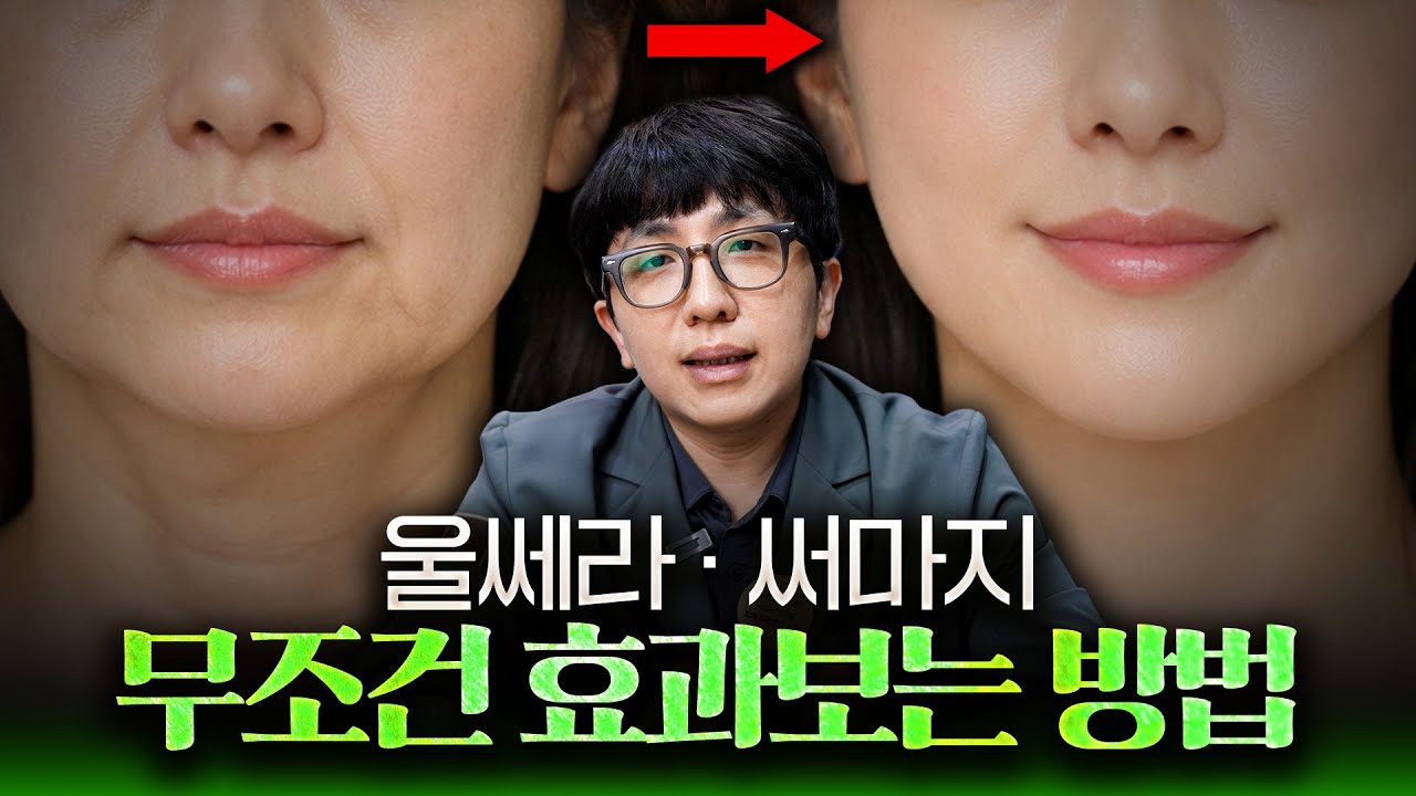 울쎄라 써마지 받을까 말까?