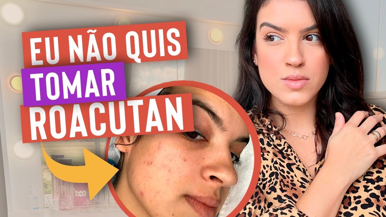 COMO ME LIVREI DAS ESPINHAS OU ACNE DA MULHER ADULTA?