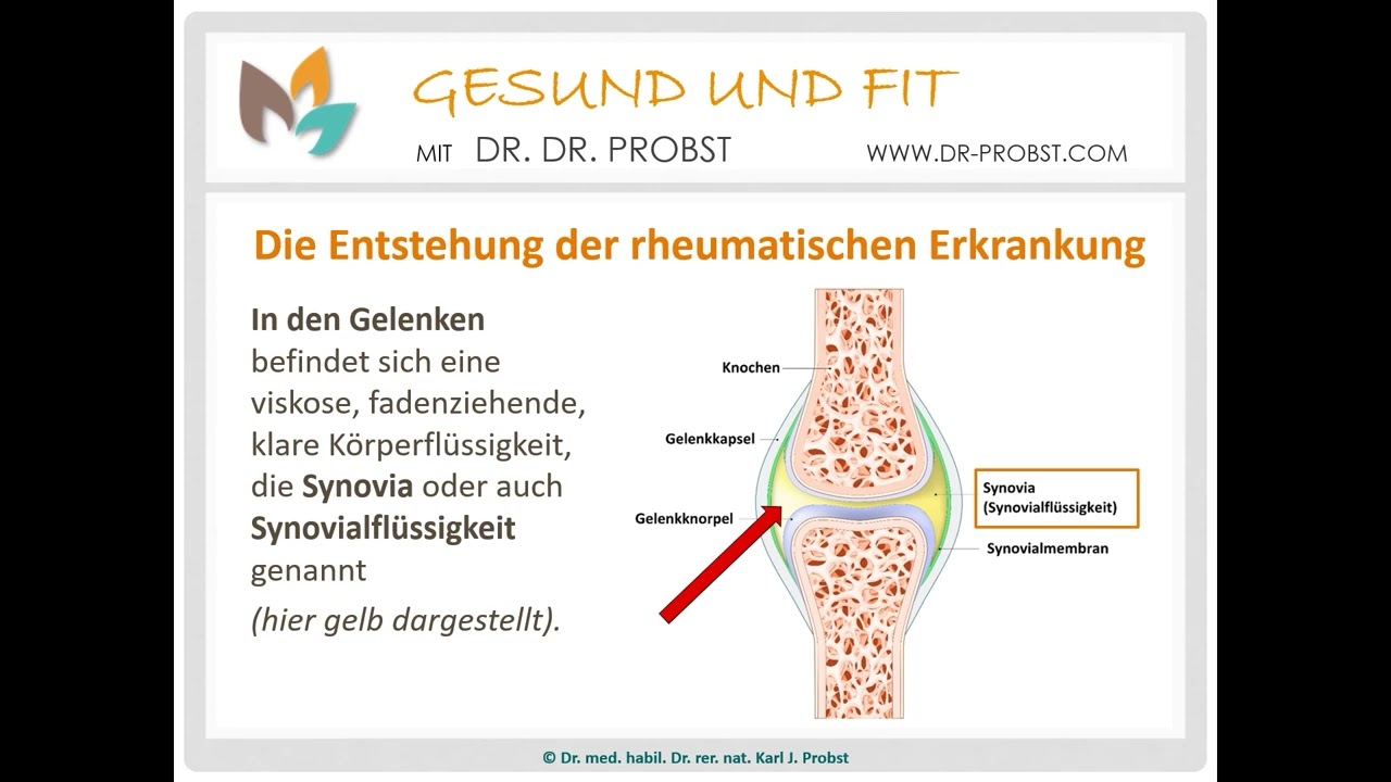 Rheuma nat&uuml;rlich heilen und vorbeugen