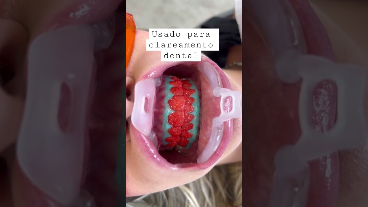 Dica para clareamento dental! #clareamentodental #dentistry #dentista #dentes