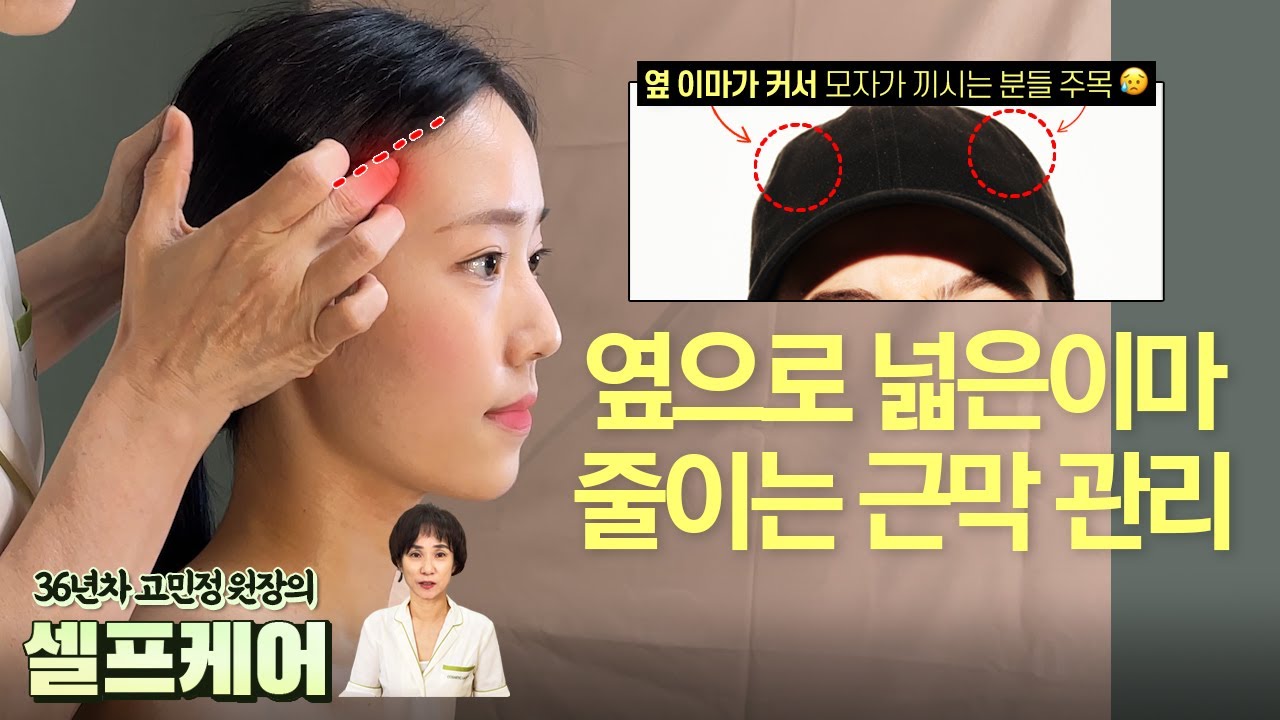 두상 옆으로 넓은 사람들 필독! 이마 가로 사이즈 줄이고 예쁜 두상 만들기