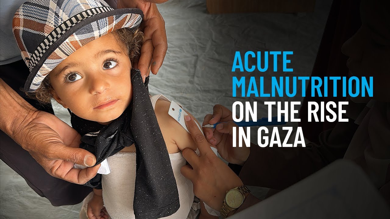 Acute Malnutrition on the Rise in Gaza