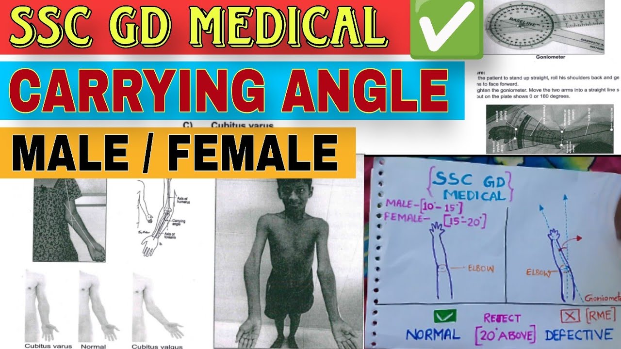 🇮🇳SSC GD MEDICAL ||✅CUBITUS VALGUS ||◀️CUBITUS VARUS || 😳CARRYING ANGLE ||💪SSC GD ELBOW CHECK ✔️