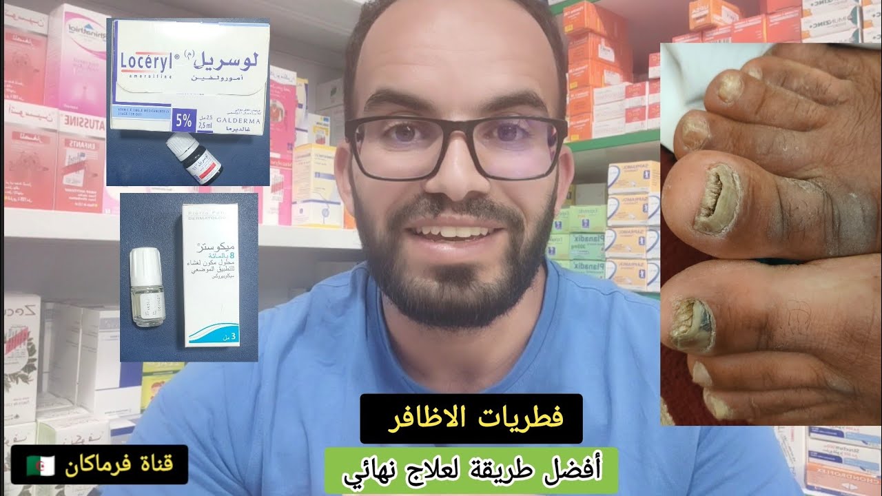 فطريات الاظافر  | أفضل طريقة لعلاج نهائي