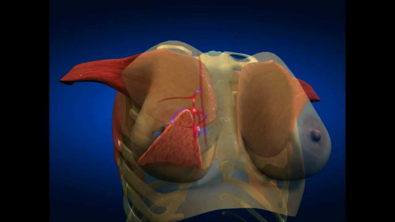 Plastic Surgery Update: Over-50 Facelifts, Laser Hair Removal, New Breast Lift Method