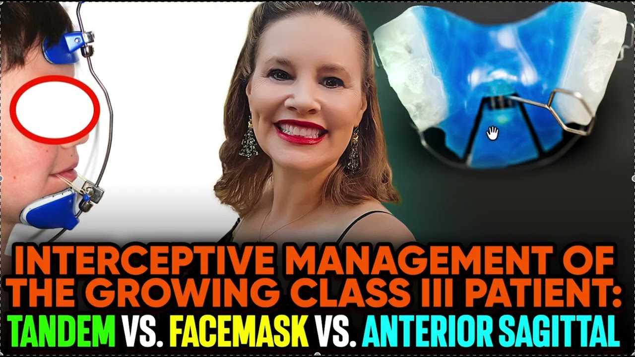 Interceptive Class 3 Cases: Protraction Face mask, Tandem vs Anterior Sagittal