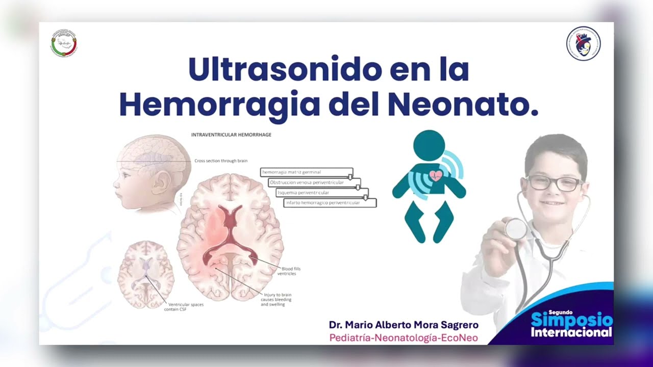 ECOGRAFIA DE LA HEMORRAGIA INTRACRANEAL NEONATAL | MÓDULO NEUROLÓGICO 2