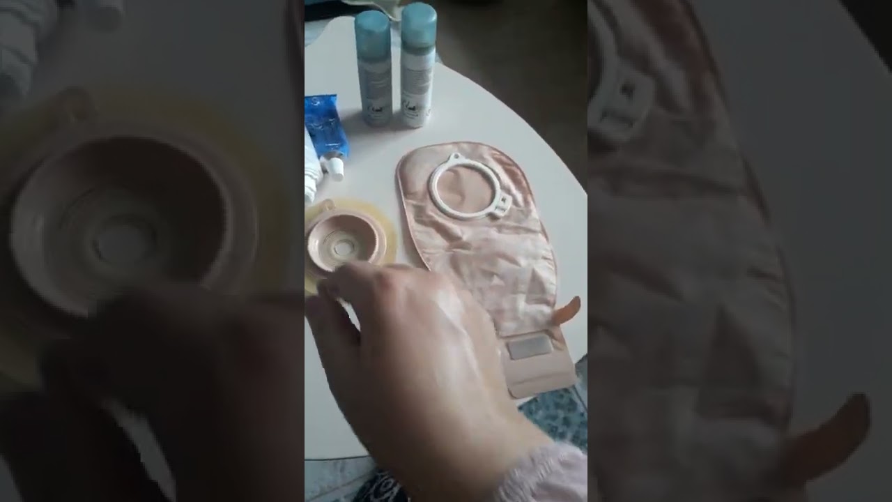 kolostomi torbası değişimi ve bakımı#kansersizyasam #hastalık #turnip_live #youtube