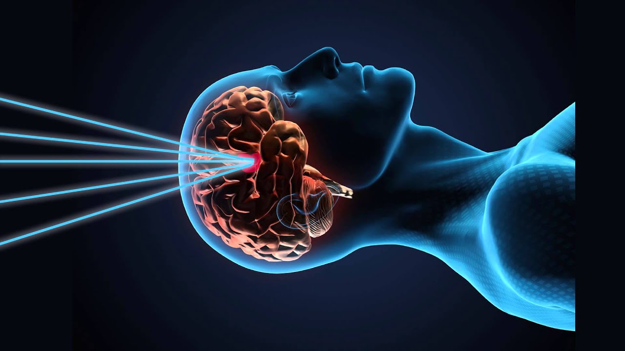 South Sound Gamma Knife