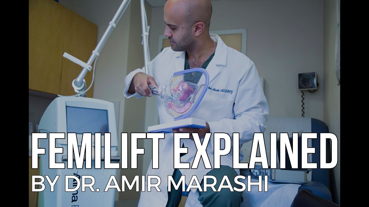 FemiLift Explained by Dr. Amir Marashi | Vaginal Rejuvenation