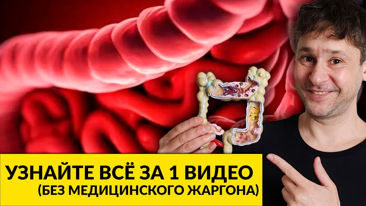 ЯЗВЕННЫЙ КОЛИТ БЕЗ ТАЙН: Сравниваем Виды и Методы Терапии