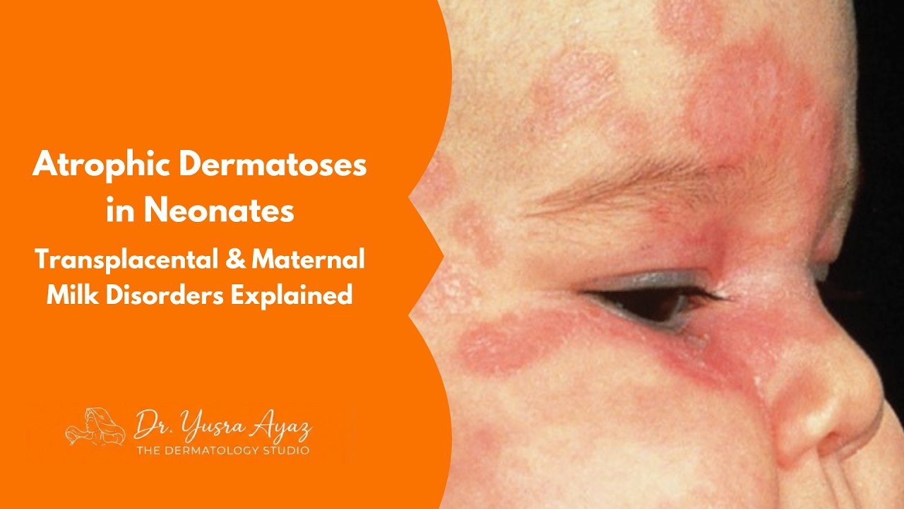Lecture 3: Atrophic Dermatoses in Neonates, Transplacental & Maternal Milk Disorders Explained