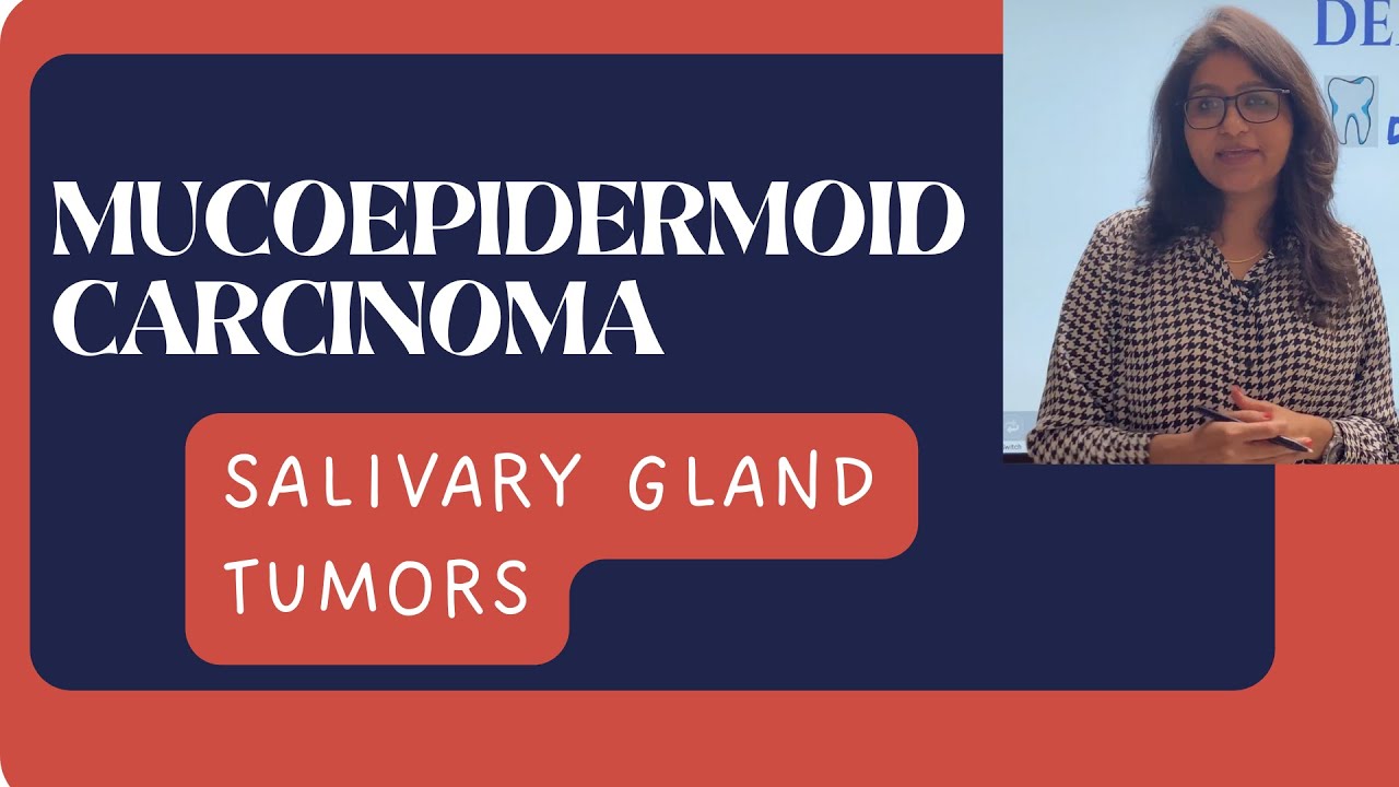 MUCOEPIDERMOID CARCINOMA I SALIVARY GLAND TUMORS I