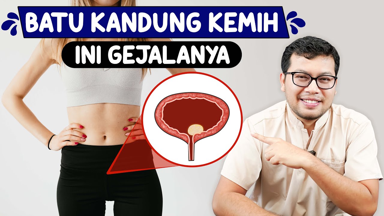 BATU KANDUNG KEMIH BEGINI GEJALANYA - DOKTER SADDAM ISMAIL
