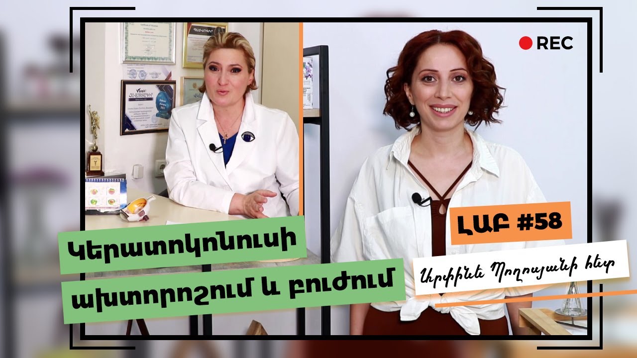 Կերատոկոնուս ախտորոշում և բուժում | Քրոսլինքինգ | Կերատոպլաստիկա
