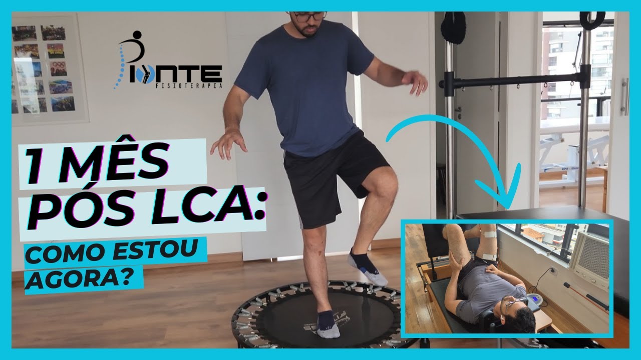 🎯 1 Mês Após Cirurgia de LCA: Como Está Indo a Recuperação?
