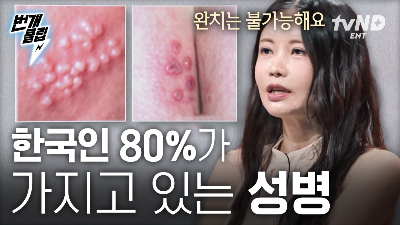 [#어쩌다어른10주년] 예방만이 길📢 한국인 80%가 가지고 있는 성병에 관한 이야기 | #번개클립