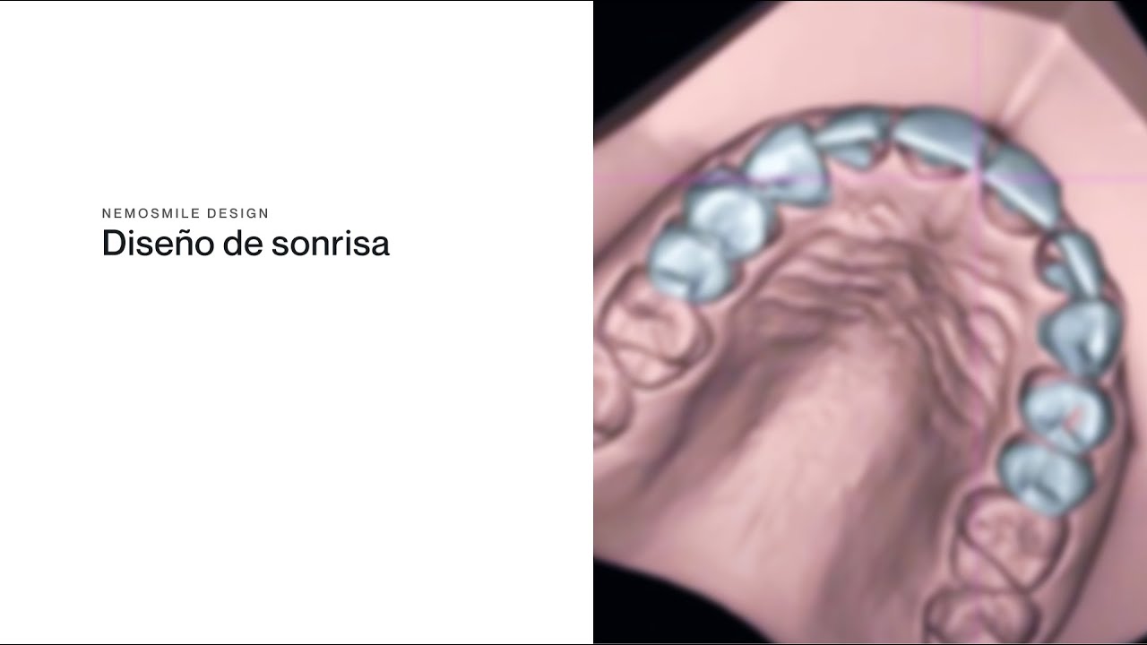 NemoSmile