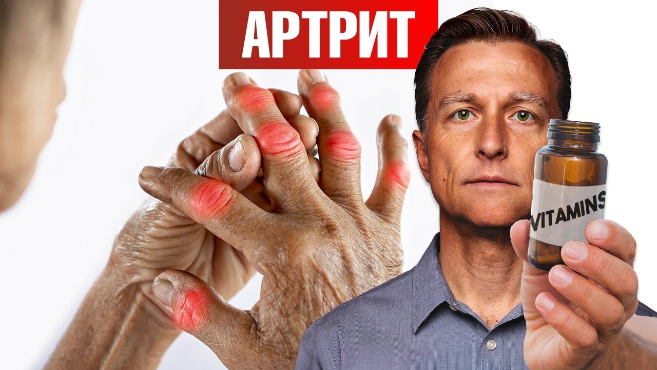 The Best Vitamin for Arthritis (And It's NOT Vitamin D) 👀