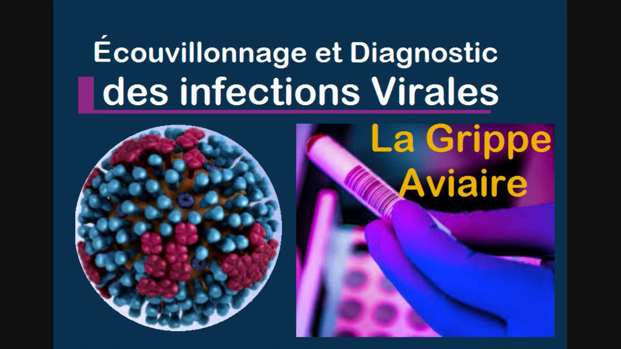 Précautions du Prélèvement par écouvillonnage PCRdiagnostic devant infections virales Grippe Covid19