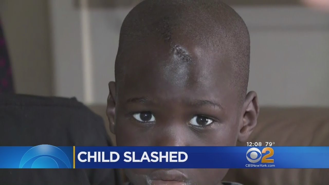 Police Seek Man Who Slashed 6-Year-Old At Bronx Mosque
