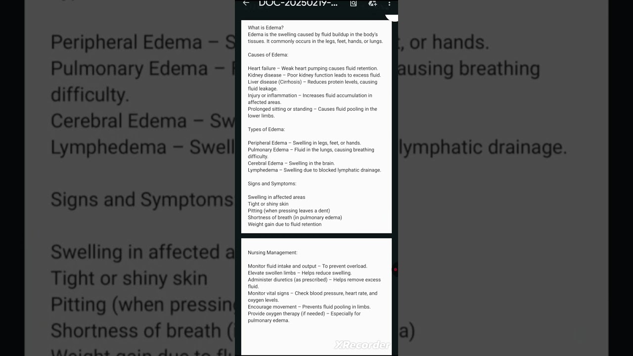 Edema note's in simple language 