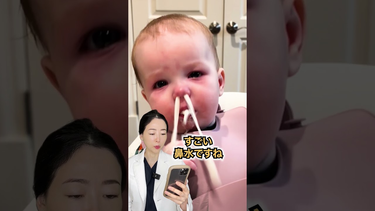 【赤ちゃんの鼻水】 出過ぎ！溜まってた膿性鼻汁がロケット噴射#shorts