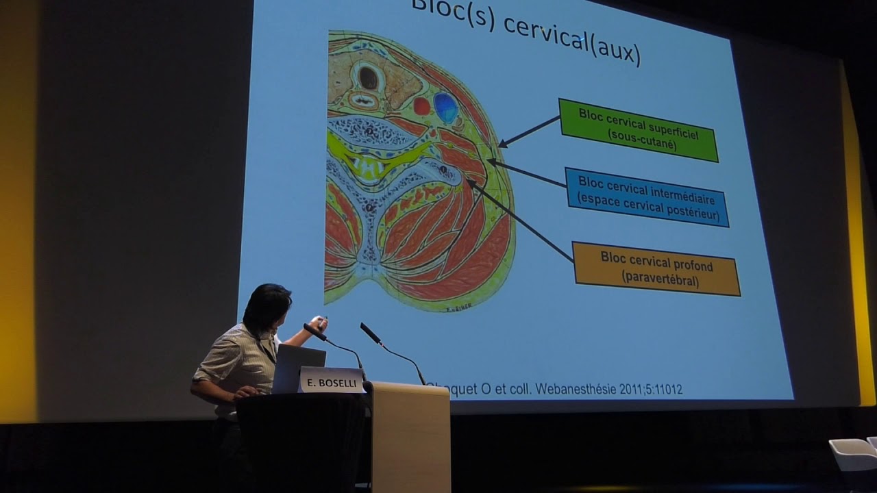 AEA 2018 - Blocs pour chirurgie carotidienne - Dr EMMANUEL BOSELLI
