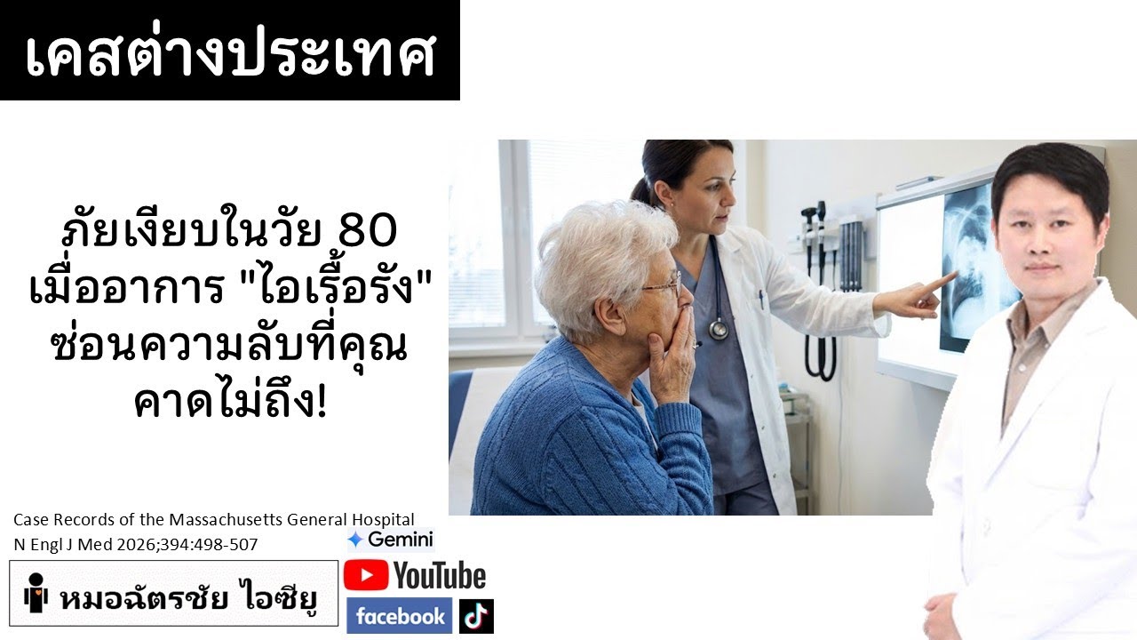 อุทาหรณ์วัยเกษียณ แค่ไอกับงูสวัด จบที่เอชไอวีระยะสุดท้าย