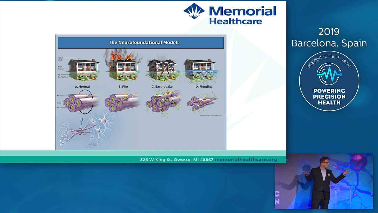 Neurofilament Light Chain: Real World Applicability in Multiple Sclerosis