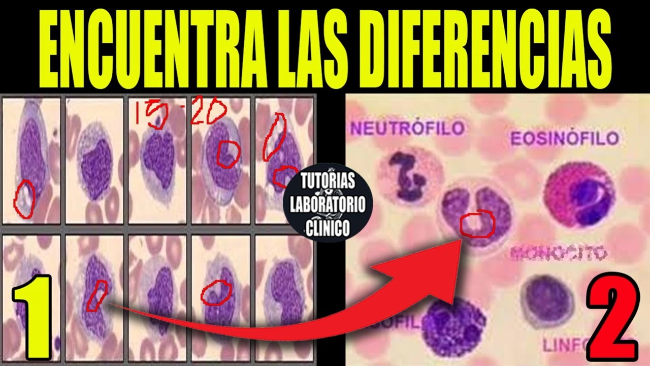 🩸Células Sanguíneas MADURAS de la Línea Blanca: Neutrófilo, Eosinófilo, Monocito, Linfocito,Basófilo