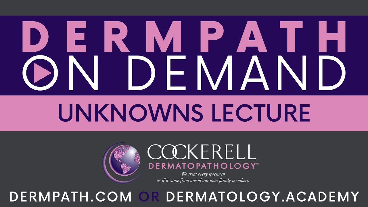 Unknowns | Episode 49