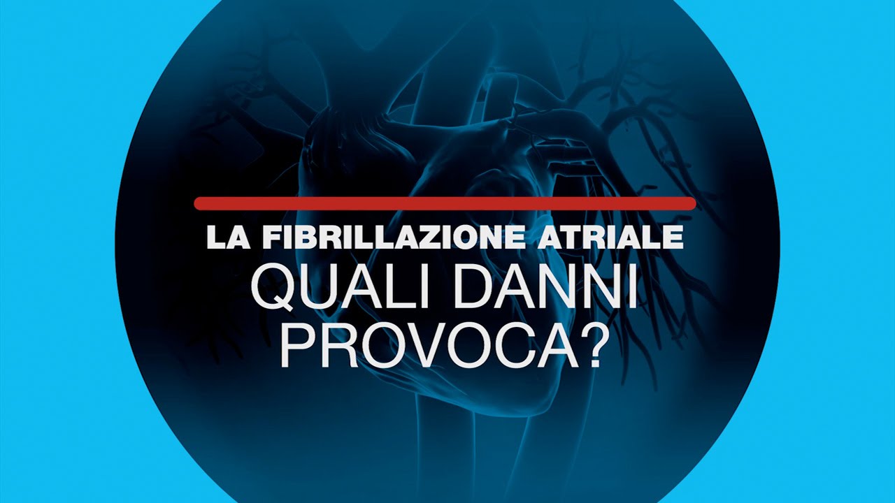 SECONDA PUNTATA - La fibrillazione atriale, quali danni provoca?