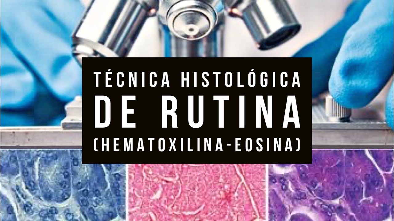 Técnica histológica de rutina (Hematoxilina-Eosina)