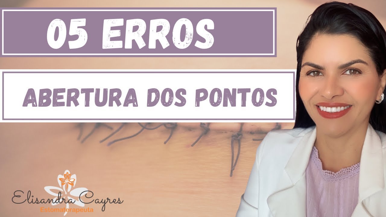 05 ERROS MAIS COMUNS NA DEISCÊNCIA CIRÚRGICA - ABERTURA DOS PONTOS