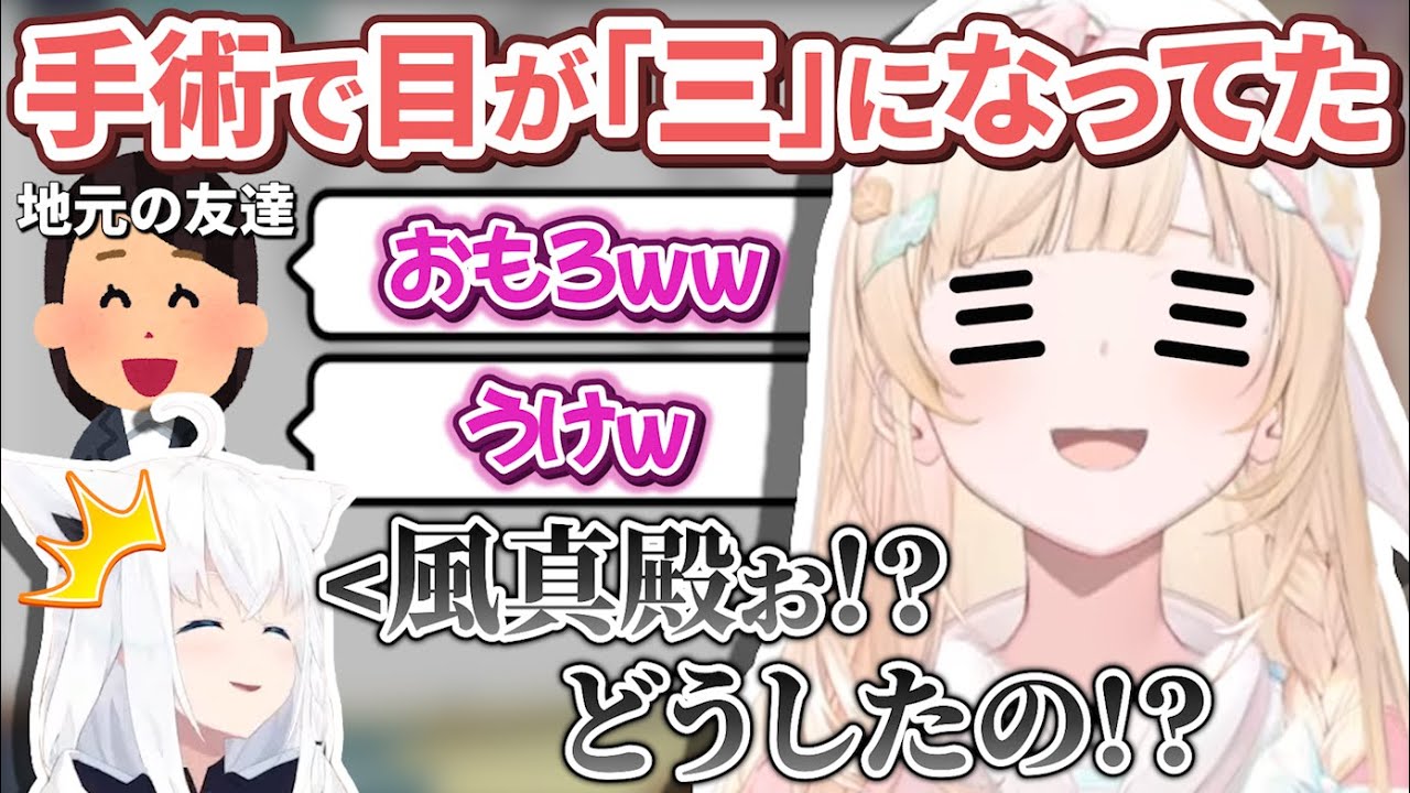 まさかの初診で目の手術を受けて目が「三」になってしまい周囲を爆笑させていた風真殿【風真いろは/ホロライブ切り抜き/holoX】