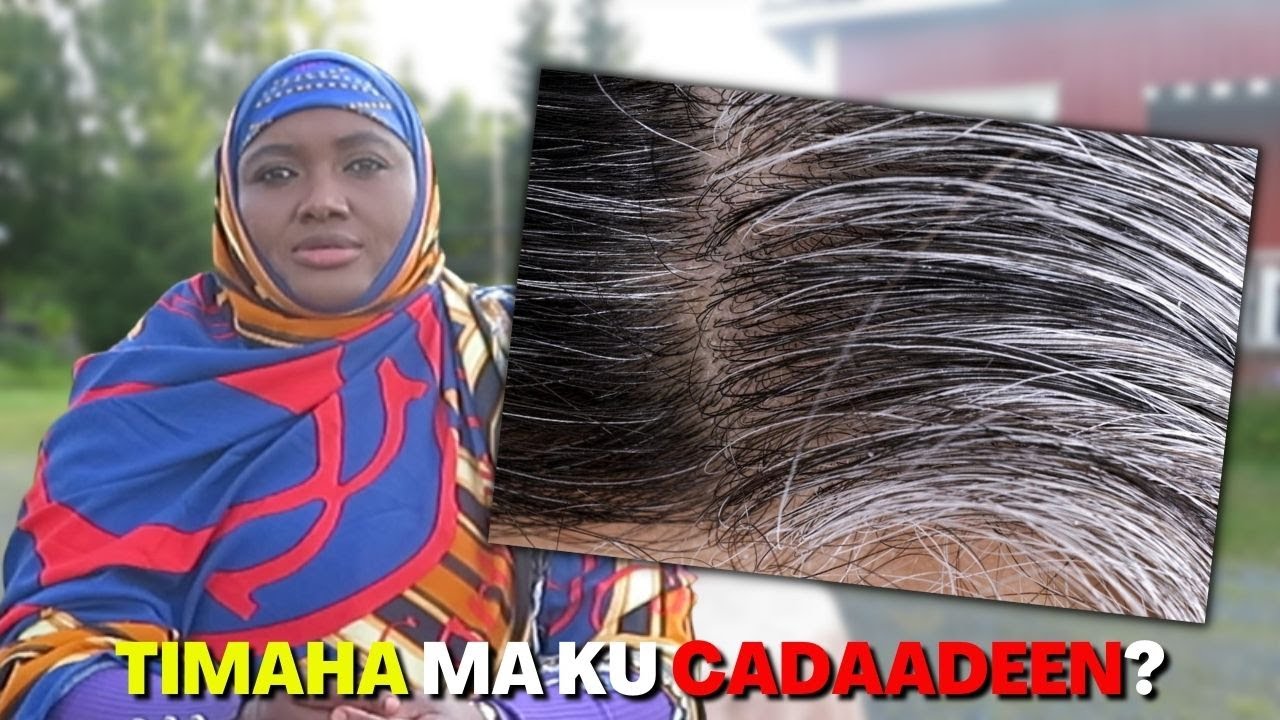 MAXAA KUGU SOO DEDEJIYAY TIMAHA IN AY KU CADDAADAAN?