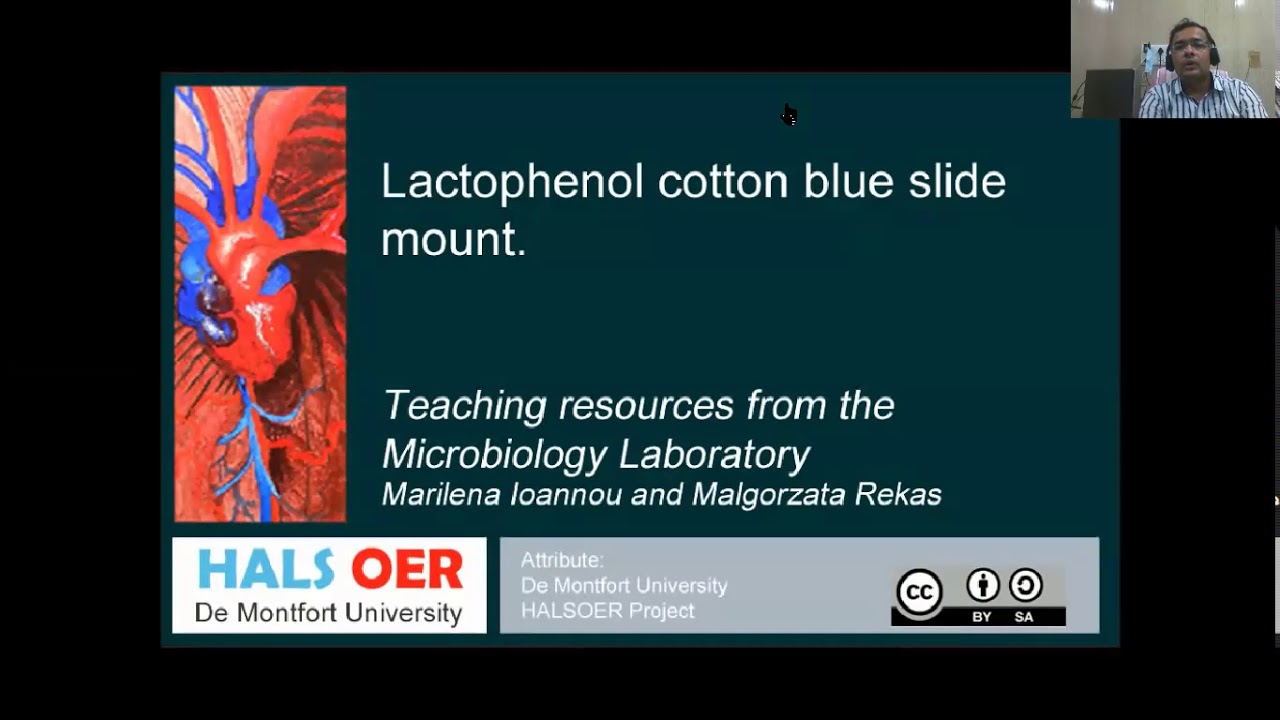 Lactophenol cottonblue Staining - Fungi