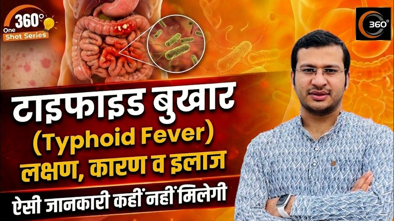 Typhoid Fever: Causes, Symptoms & Prevention | 360 Degree One Shot Series🔥| Siddharth Sandu Sir