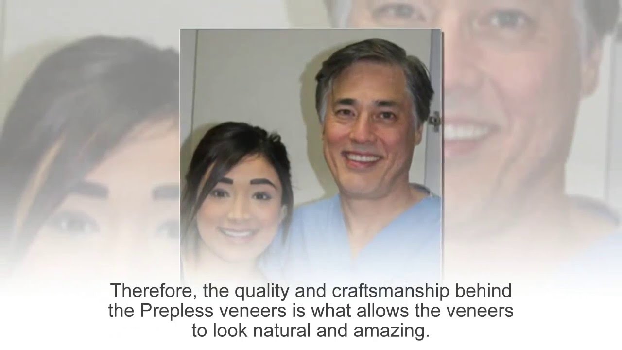 Prepless Veneers Treatment at Cosmetic Dental Associates San Antonio, TX Dental Practice