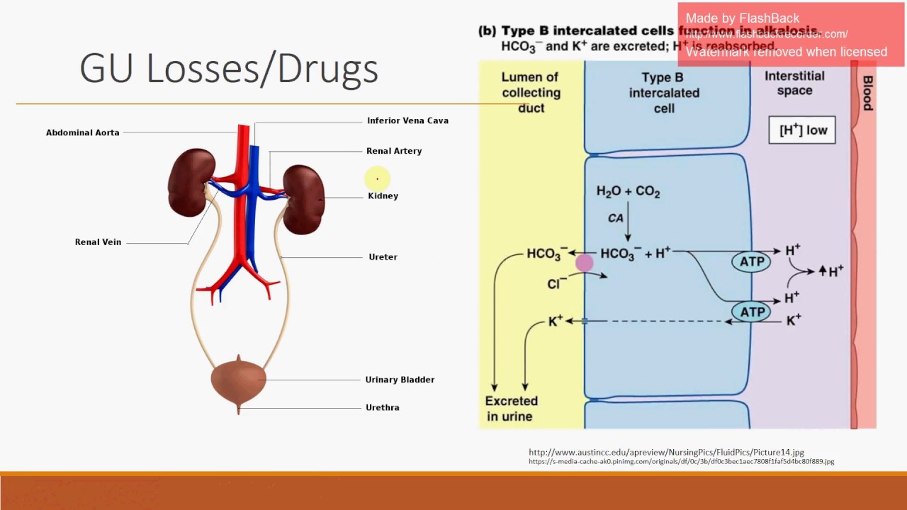 Non-Anion Gap Metabolic Acidosis - Updated Version