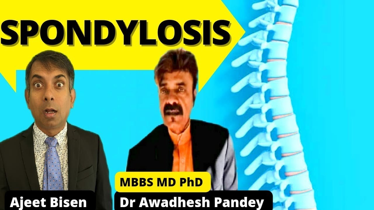 ➿Spondylosis/Spondylitis से निदान,इतना आसान :Dr Awadhesh Pandey #ajeetbisen