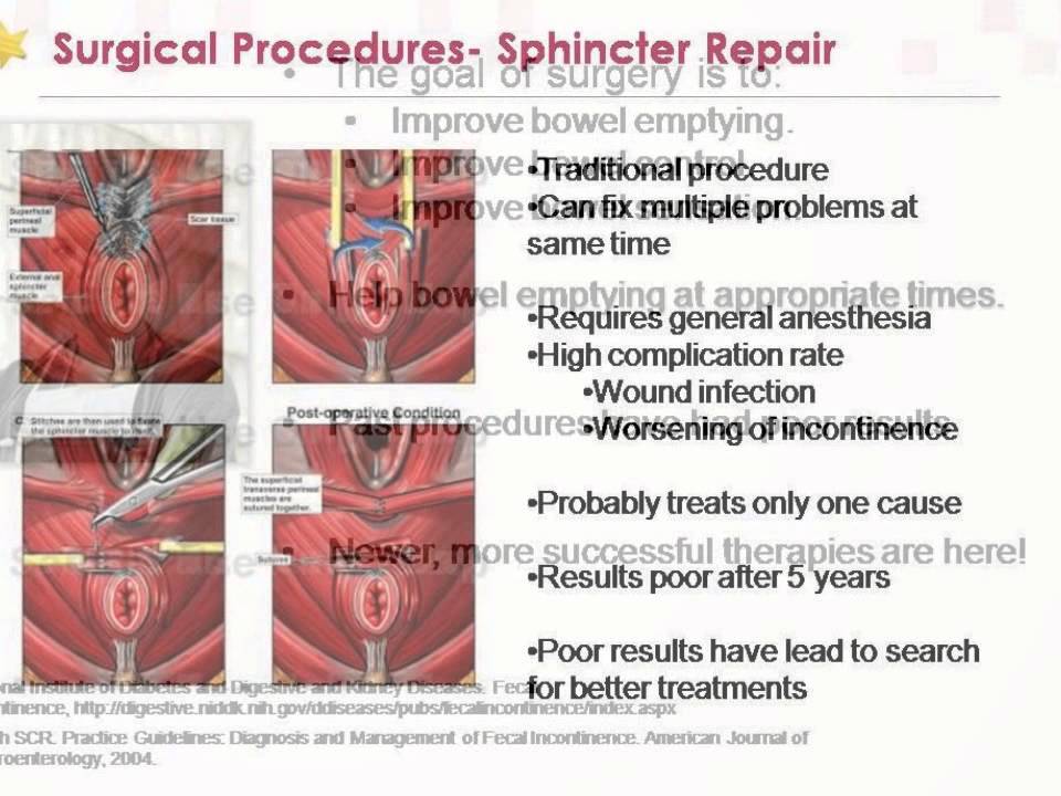 Fecal Incontinence, Anal Leakage - what you need to know